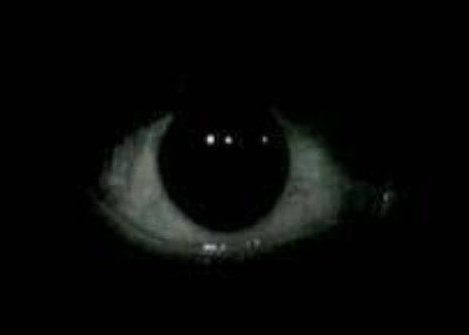 eye